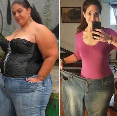 before and after weight loss 1